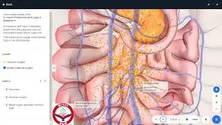 Diabities Milltis 3d/Symptoms and treatment of diabities/digestion system diseases/mbbs prof1/nmdcat