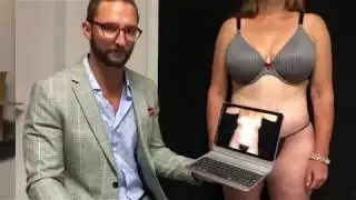Abdominoplasty with Progressive Tension Sutures by Dr. Michael Rossi