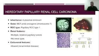 Hereditary Renal Cell Carcinoma (RCC) Syndromes