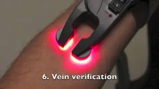 Venoscope FINAL