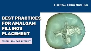 Best Practices for Amalgam Filling Placement
