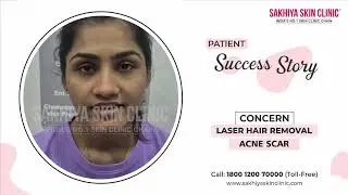 Top Acne Scar Removal Clinic in India | Real Patient Experience at Sakhiya Skin Clinic