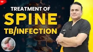 Spine TB Ka Ilaj | Spinal Infection Treatment &ndash; Complete Recovery Possible? #spine #tb #infection