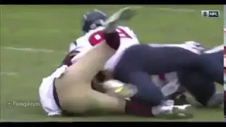 Alex Smith Gruesome Leg Injury