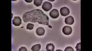 Globulo bianco rincorre e fagocita batteri