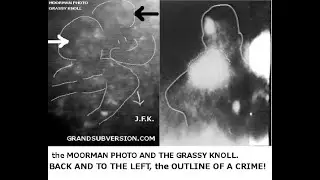 JFK ASSASSINATION PROOF OF SECOND SHOOTER GUNMAN GRASSY KNOLL PRESIDENT JOHN F KENNEDY
