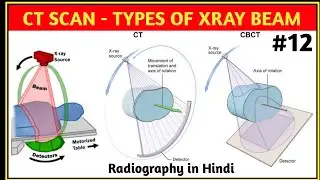 Type of X-ray Beam