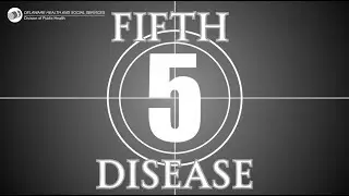 Fifth Disease | Frequently Asked Questions