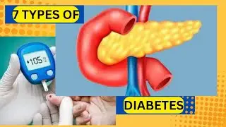 IDENTIFYING THE 7 TYPES OF DIABETES