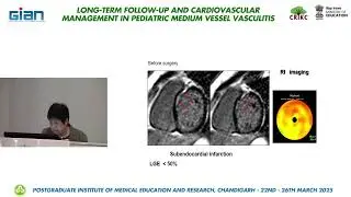 L17 Cardiovascular Follow-up and role of Stress testing in Kawasaki disease