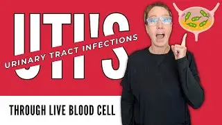 Chronic UTIs 🦠 and Offering Solutions for Relief!