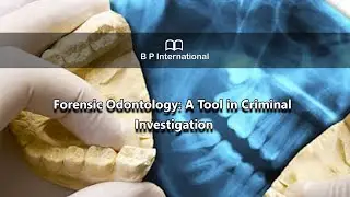 Forensic Odontology: A Tool in Criminal Investigation