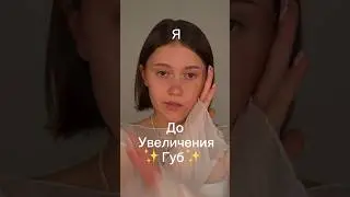 ДО и ПОСЛЕ увеличения ГУБ ✨