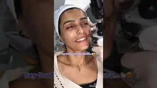 1540 Erbium Laser 👍🌺