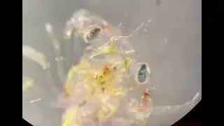 Zoea, essa &eacute; uma larva de caranguejo vista ao microsc&oacute;pio.