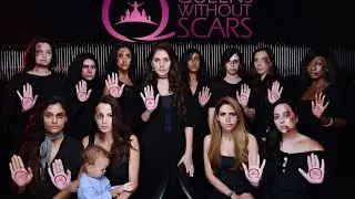 WUD BACKSTAGE - QUEENS WITHOUT SCARS