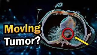 4D CT Scan Explained: Why 
