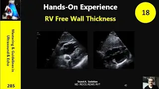 Hands-on Experience 18: Right Ventricle free wall thickness