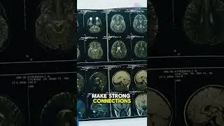 Why Do We Forget Things? Here&rsquo;s the Science! #MemoryHacks #BrainScience #Psychology #MindPower