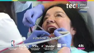 Planeamento Digital de Tratamento com Digitaliza&ccedil;&atilde;o Intraoral e Simula&ccedil;&atilde;o 3D