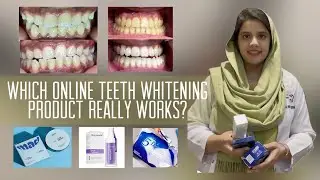 Online Available Teeth Whitening Products are Fake or Real? Teeth Whitening at Home| Honest Review