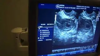 Primeira Ultra ! 3 semanas...
