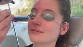 Pulse Dye Laser Skin Treatment Up Close | Board Certified Facial Plastic Surgeon