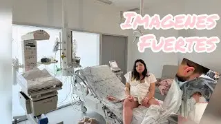 MI PARTO TRAUM&Aacute;TICO ❤️&zwj;🩹