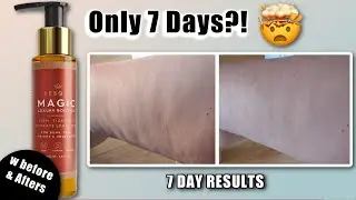 7 Days to Smoother Thighs ✨ Besque Magic Oil Cellulite & Firming Results! 🤯
