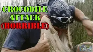 CROCODILE ATTACK (Horrible) | NEVER PLAY with CROCODILES | FailLord International