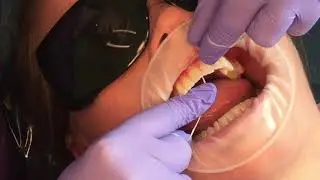 Dental Flossing Made Easy | Integrated Dentalcare #edinburgh #dentalhygiene #dentalflossing