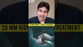 20 mm kidney stone treatment | How to remove 20 mm kidney stone | Fans Rirs #kidneystones