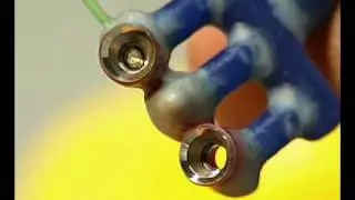 Implantatversorgung einer verkuerzten Zahnreihe