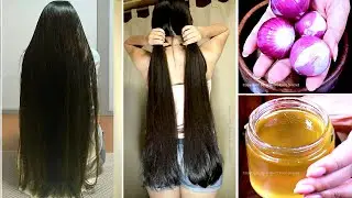 1 Week Challenge - Grow Your Hair Super Faster | After Doing this Your Hair will Never Stop Growing