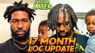 17 Month Loc Update I Made a Huge Mistake! Massive Glue-like Build Up! Seborrheic Dermatitis