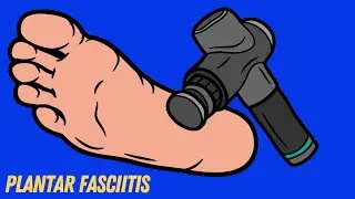 Can a Massage Gun help to reduce Plantar Fasciitis pain?  How to use a Massage Gun on the Feet
