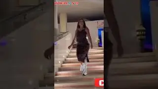 Beautiful amputee lady prosthetic user | mobility #prostheticleg