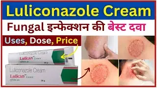 Luliconazole Cream use in hindi | Antifungal medicine 💊 | Treatment of fungus| Skin infection