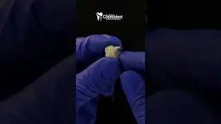 Single Missing Tooth See The Zirconia Dental Implant Process in our Mumbai Clinic  Ti Base