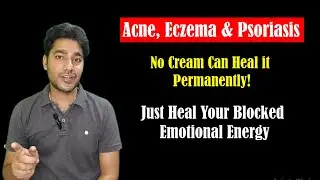 Cure Acne, Eczema and Psoriasis by Healing Your Trapped Emotions!