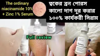 the ordinary serum review |অর্ডিনারি সিরাম ব্যবহারের নিয়ম!ত্বকের ব্রন দাগছোপ দূর করে ত্বক ফর্সা করবে