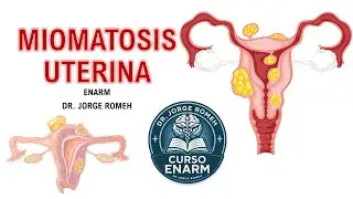 MIOMATOSIS UTERINA  - ENARM - TODO LO QUE DEBES SABER