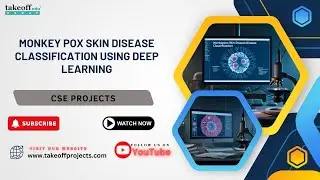 Monkeypox Skin Disease Classification Using Deep Learning