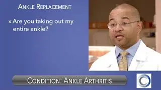 What is Ankle Arthritis? | Dr. Sealey | Danbury, CT