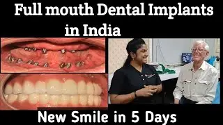 Full mouth Dental Implants in India - Best dental implant Centre / Australian patient's Experience !
