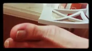 Lelijke voeten 1