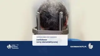 𝐌𝐨𝐜𝐨𝐰𝐚𝐧𝐢𝐞 𝐫𝐚𝐦𝐲 𝐬𝐭𝐞𝐫𝐞𝐨𝐭𝐚𝐤𝐭𝐲𝐜𝐳𝐧𝐞𝐣 w Centrum Gamma Knife Warszawa