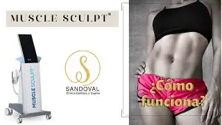 &iquest;C&oacute;mo funciona MuscleSculpt?