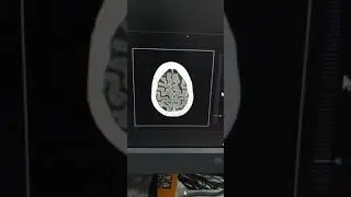 Brain ct scan plain video