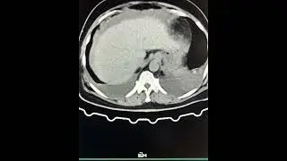 Petro mastoid region scan